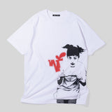 F type TS technique RL