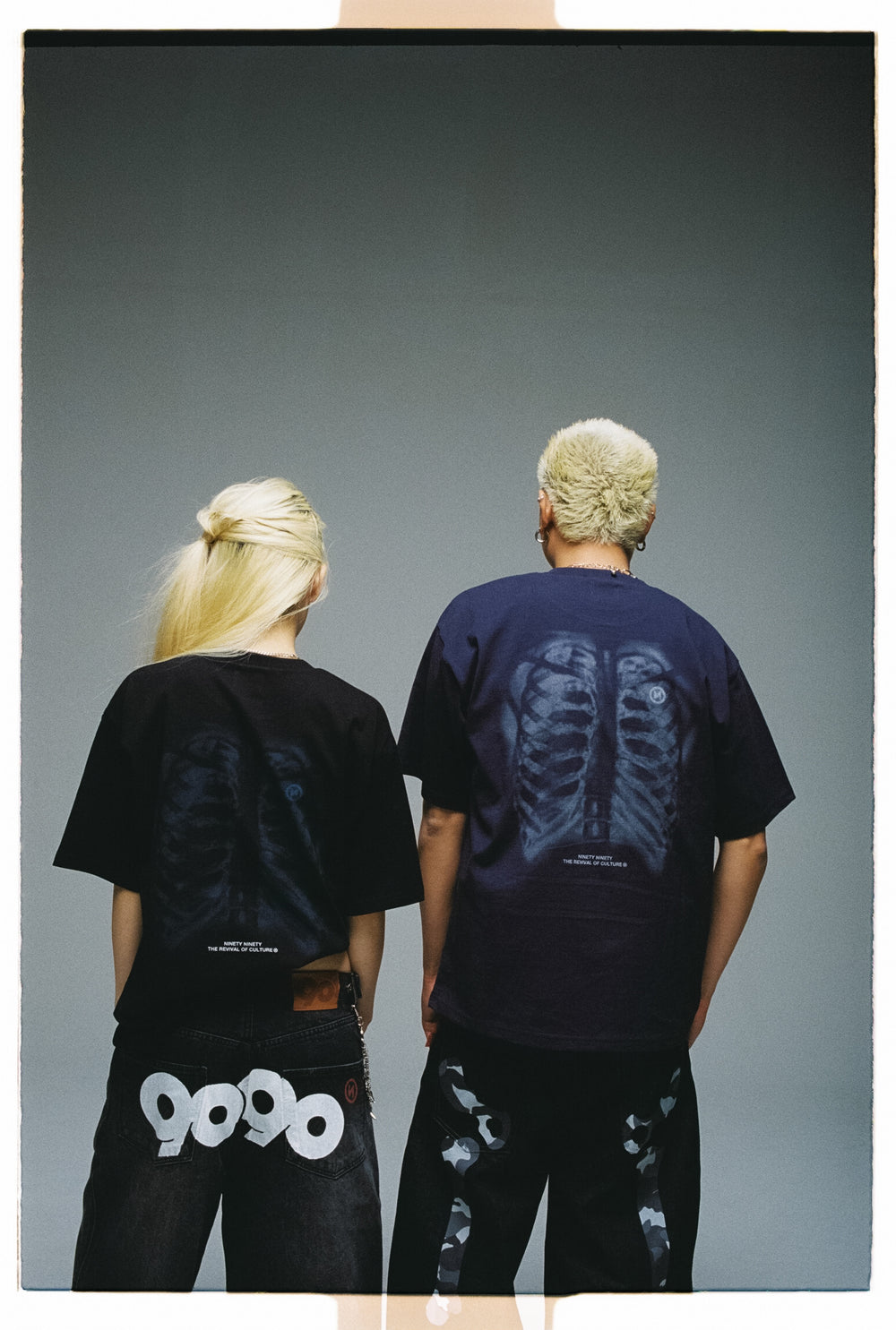 X-ray Bone Tee – YZ