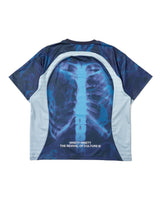 X-ray Bone Game Shirt 