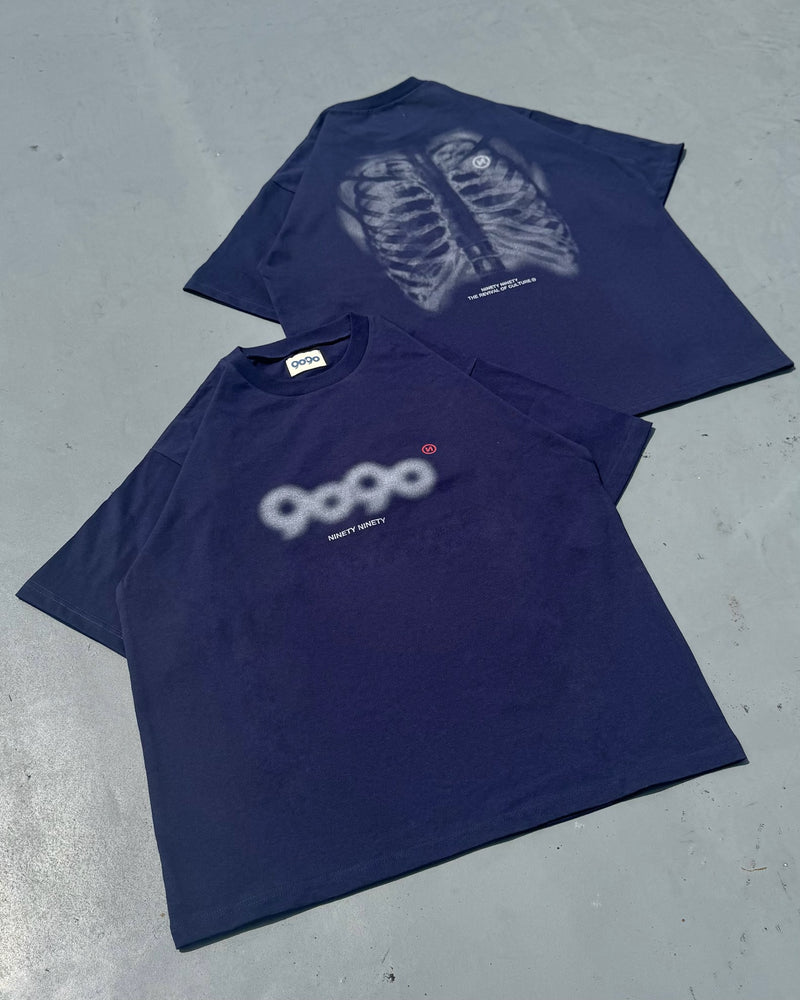 X-ray Bone Tee – YZ